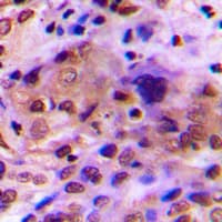 Polyclonal Rabbit anti-Human RAD51C Antibody (Internal, IHC, IF, WB)