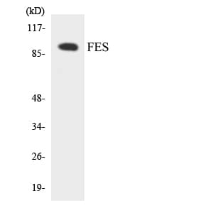 Polyclonal Rabbit anti-Human FES Antibody (aa112-161, WB)