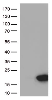 Monoclonal Mouse anti-Human ARMS2 Antibody (clone OTI2G1, WB)