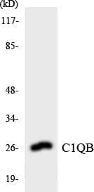 Polyclonal Rabbit anti-Human Complement C1QB Antibody (aa144-193, WB)