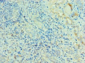 Polyclonal Rabbit anti-Human MRPL28 Antibody (aa1-256, IHC, WB)