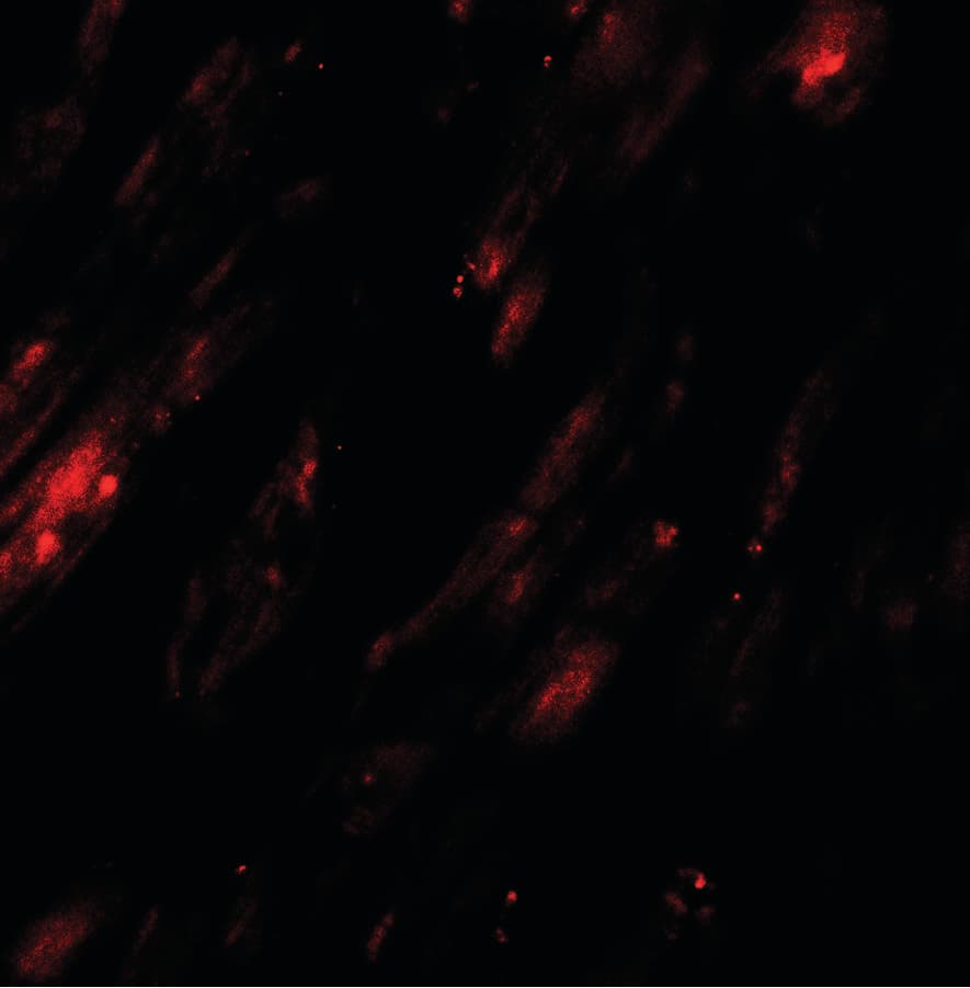 SELK / Selenoprotein K Antibody