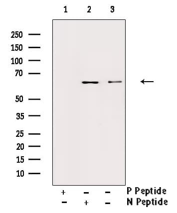 IL10RA Antibody (phospho-Tyr496)