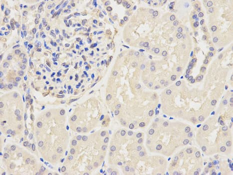 IHC-plus™ KPNA2 / Importin Alpha 1 Antibody