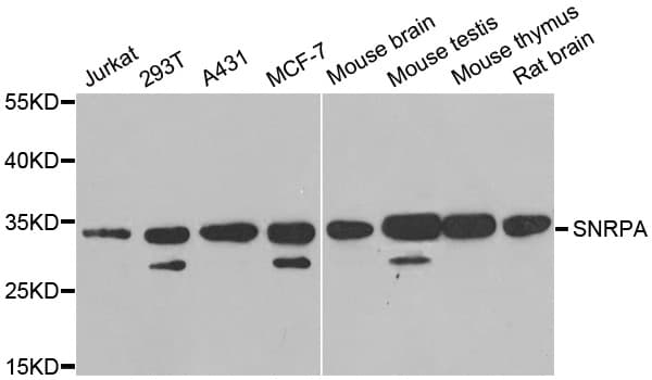 Polyclonal Rabbit anti-Human SNRPA / U1A Antibody (IHC, IF, WB)