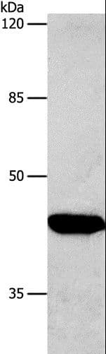 CTGF Antibody