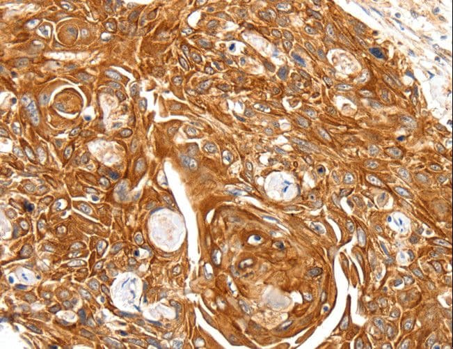SFTPA1 / Surfactant Protein A Antibody