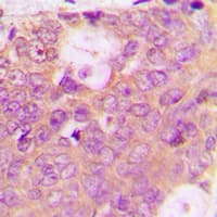 SPHK2 Antibody (C-Terminus)
