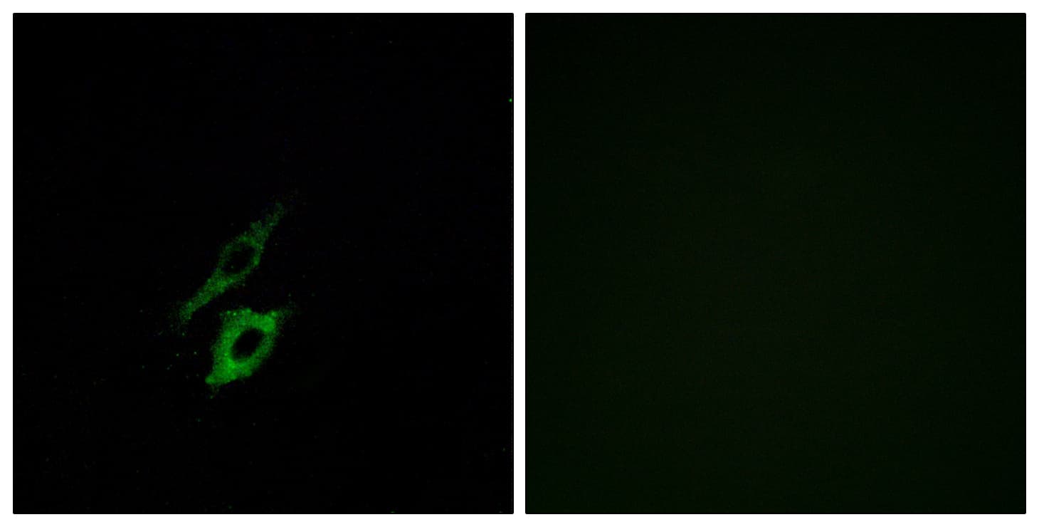 FPR1 / FPR Antibody (aa151-200)