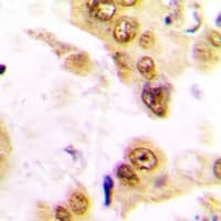SRF / Serum Response Factor Antibody (Internal)
