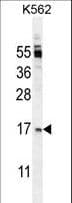 Polyclonal Rabbit anti-Human TNFSF4 / OX40L / CD252 Antibody (aa97-125, WB)