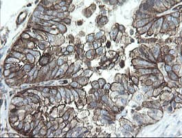 PHF7 Antibody (aa155-381, clone OTI1A2)