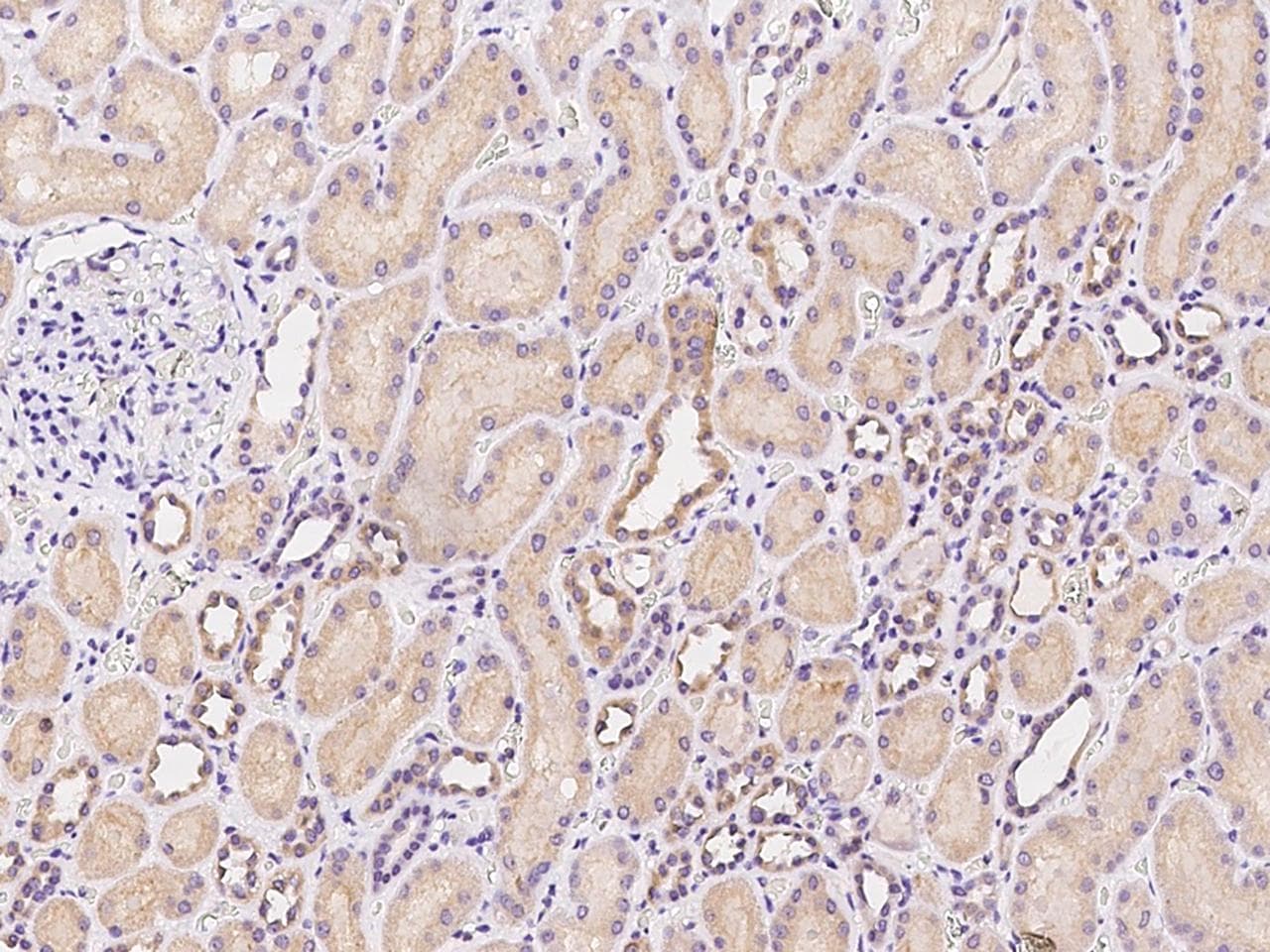 TNMD / Tenomodulin Antibody