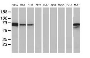 Alpha-Fetoprotein Antibody (clone OTI2A6)
