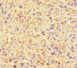 SUMO2 Antibody