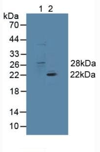 GSTT1 Antibody (aa7-240)