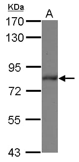 ZBTB20 Antibody