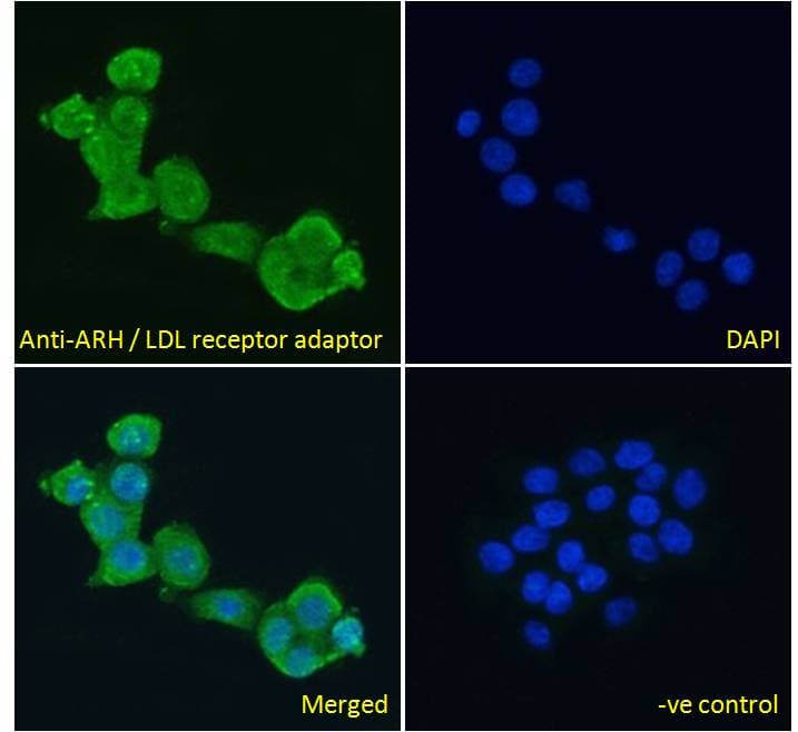 Polyclonal Goat anti-Human ARH / LDLRAP1 Antibody (aa2-14, IF)
