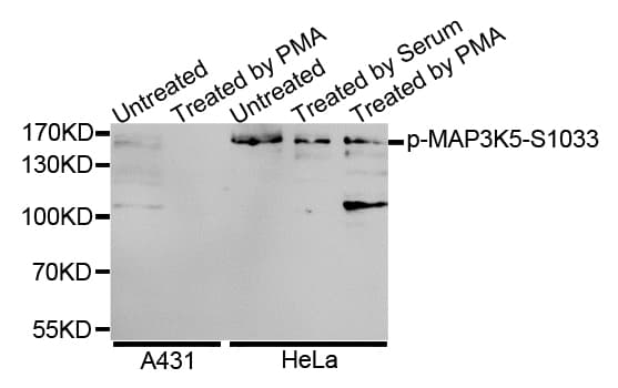 Polyclonal Rabbit anti-Human MAP3K5 / ASK1 Antibody (AP, phospho-Ser1033, WB)