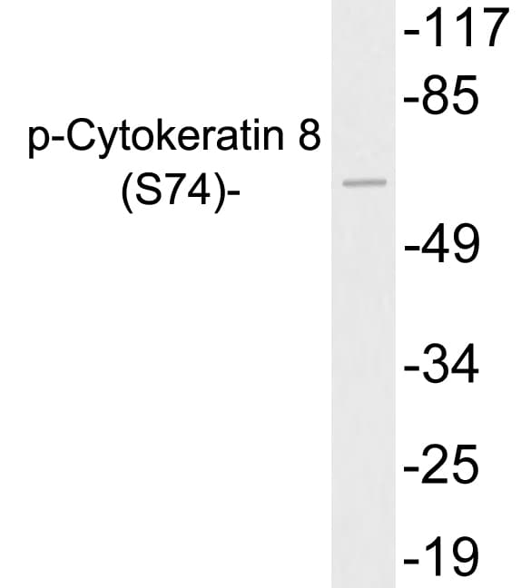KRT8 / CK8 / Cytokeratin 8 Antibody (phospho-Ser74)