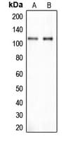 CLIP2 / CYLN2 Antibody (C-Terminus)
