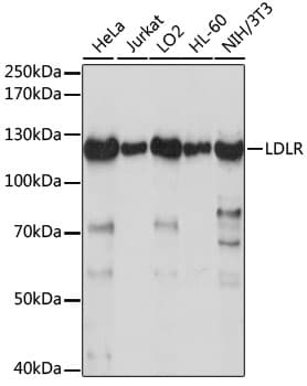 Polyclonal Rabbit anti-Human LDLR / LDL Receptor Antibody (WB)