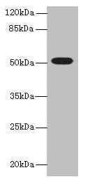 Polyclonal Rabbit anti-Human TUBB1 / Tubulin Beta 1 Antibody (IHC, WB)