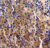 Polyclonal Rabbit anti-Human SYNE3 / C14orf49 Antibody (aa852-880, IHC, WB)