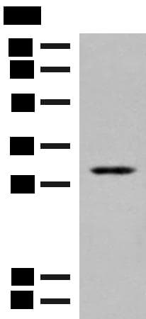 TPMT Antibody