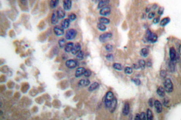 Polyclonal Rabbit anti-Human CUL1 / Cullin 1 Antibody (Tyr761, IHC, IF, WB)