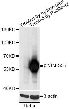 Vimentin Antibody (phospho-Ser56)