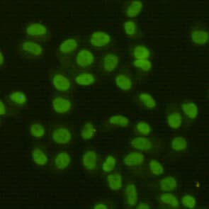 FEN1 Antibody