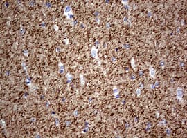 NF-L / NEFL Antibody (clone OTI3G2)