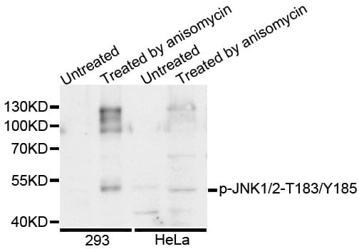 MAPK8 / JNK1 Antibody (phospho-Thr183/Tyr185)