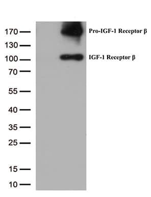 IGF1R / IGF1 Receptor Antibody (aa741-935, clone OTI4C4)