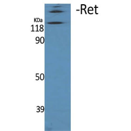 RET Antibody (850-930 aa)