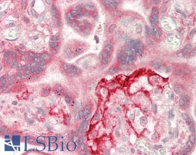 MAGEA3 Antibody (clone 1A9, Carrier-free)