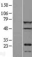 CDT1 Protein (Over-Expression Lysate Myc-DDK (Flag))