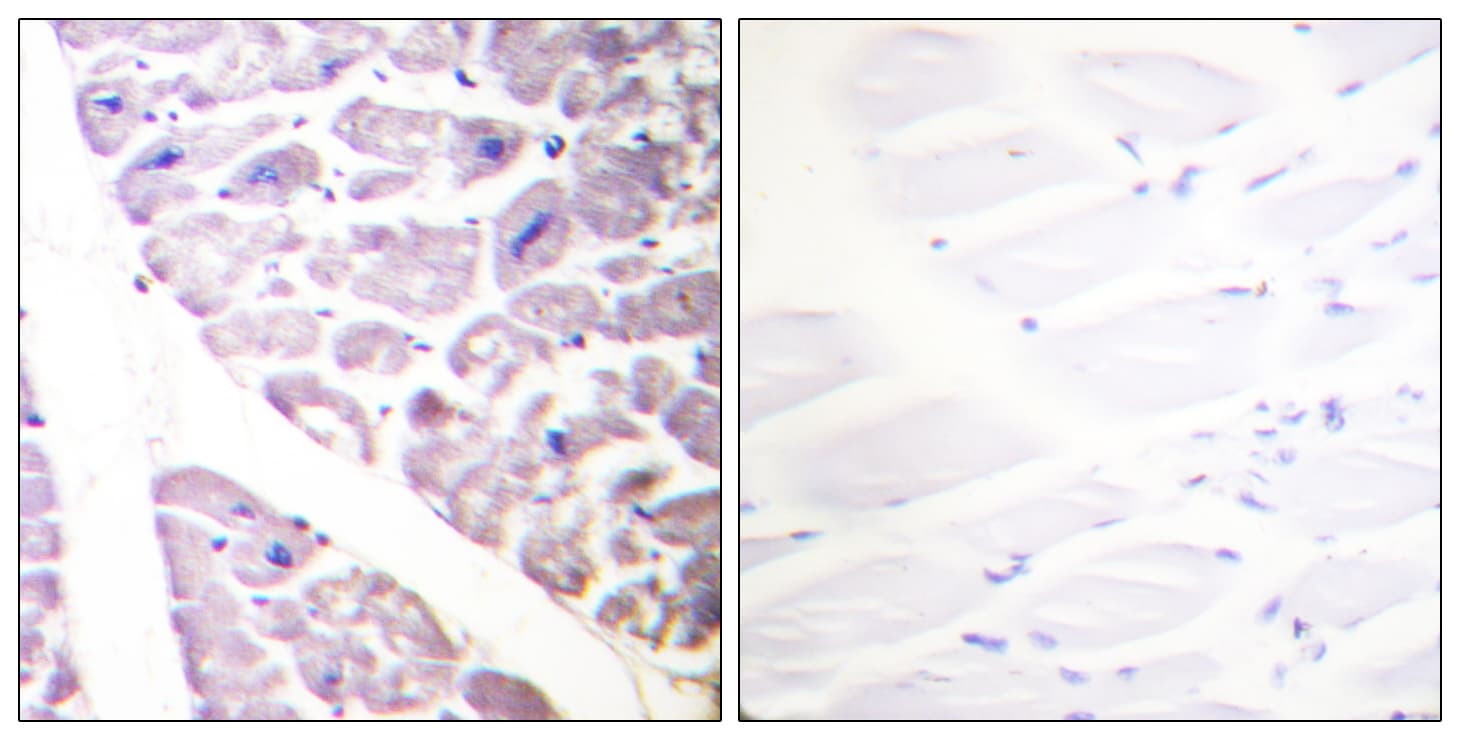 IKK Alpha+Beta Antibody (phospho-Ser176/177)