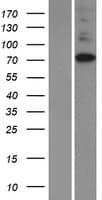 ITPKC Protein (Over-Expression Lysate Myc-DDK (Flag))