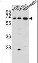 Polyclonal Rabbit anti-Human ZSCAN2 Antibody (aa117-146, WB)