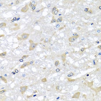 Polyclonal Rabbit anti-Human RPLP1 Antibody (IHC, IF, WB)