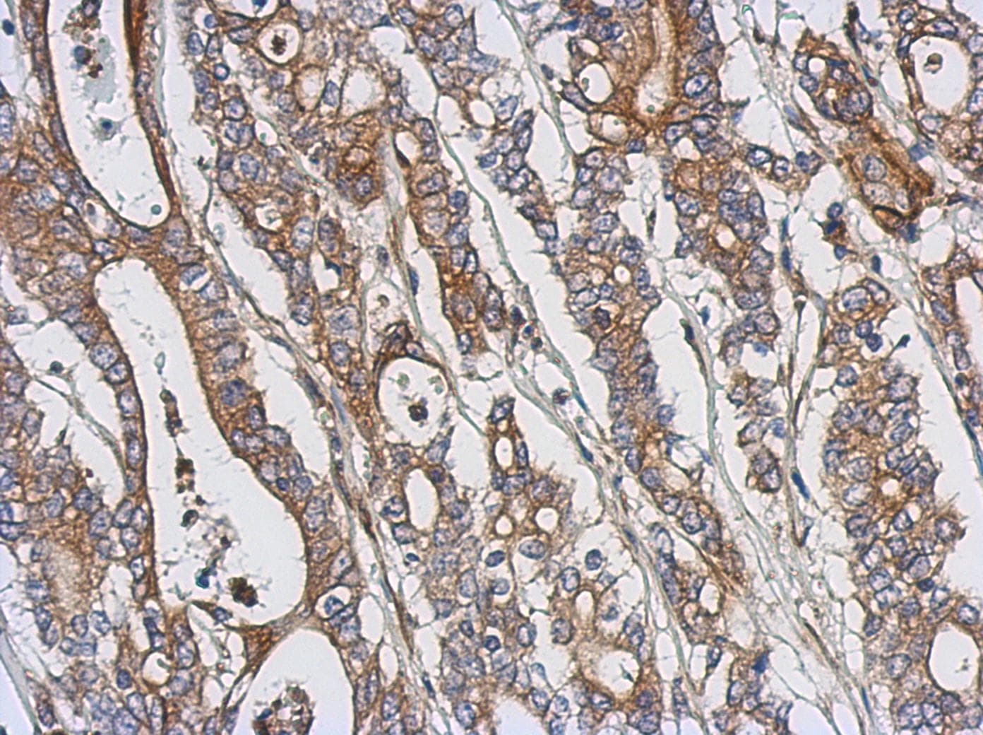 PRKCQ / PKC-Theta Antibody