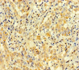 Polyclonal Rabbit anti-Human ARHGAP27 Antibody
