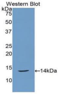 Calcitonin Antibody (aa28-138)