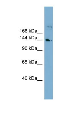 WDR35 Antibody (aa71-120)