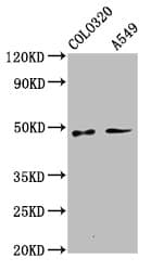 Polyclonal Rabbit anti-Human PNPLA5 Antibody (IHC, IF, WB)