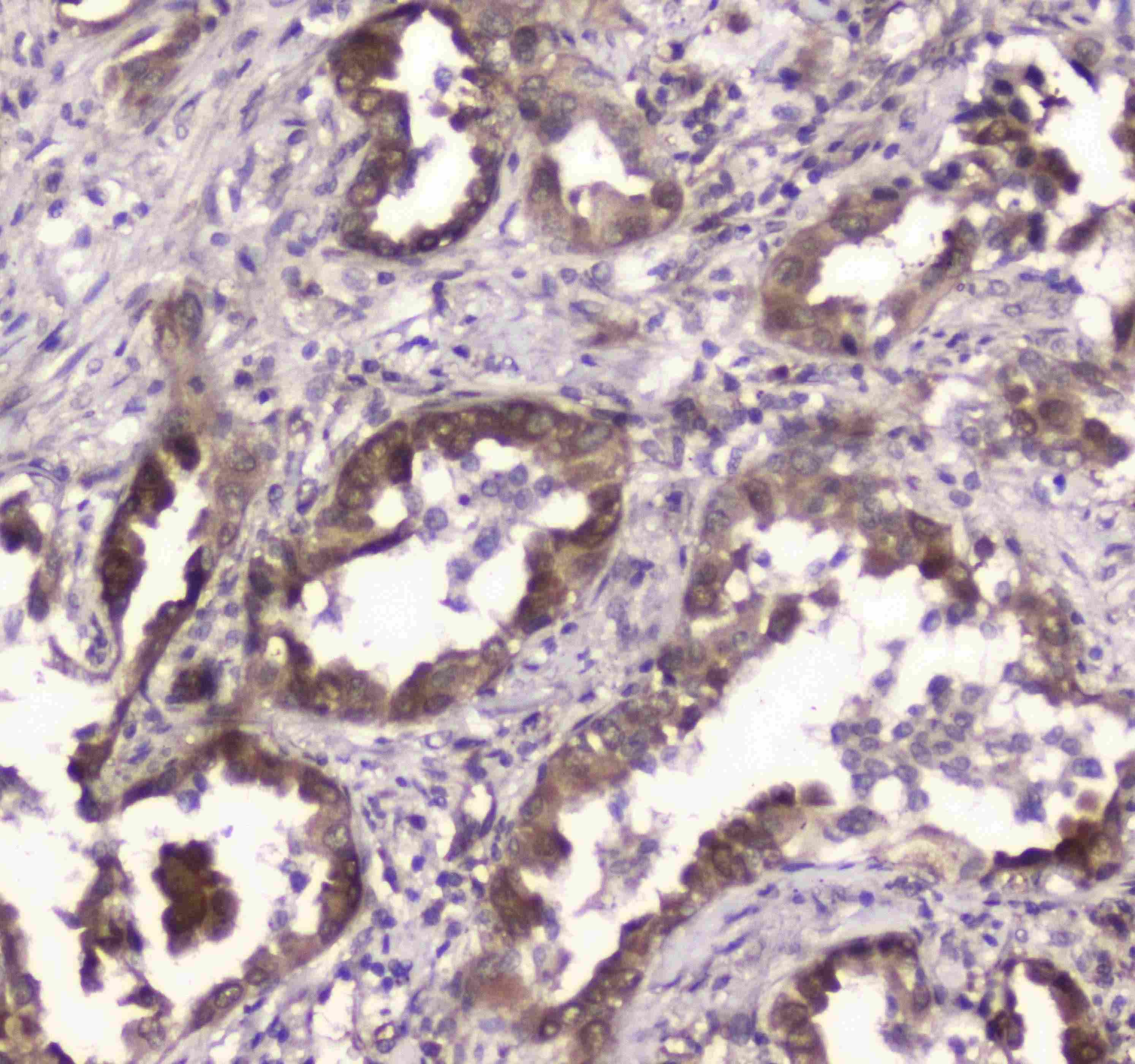 Polyclonal Rabbit anti-Human GLO1 / Glyoxalase I Antibody (IHC, WB)