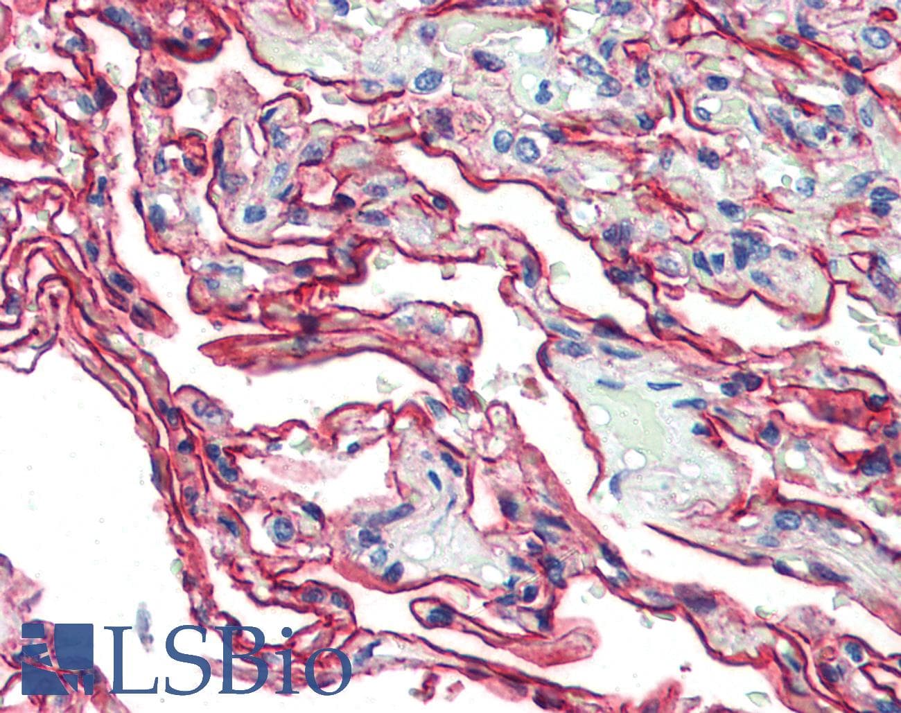 IHC-plus™ S100A10 Antibody (clone 4E7E10)