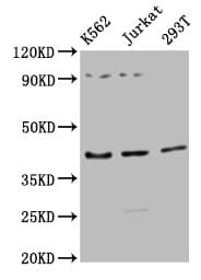 Polyclonal Rabbit anti-Human ADIPOR1/Adiponectin Receptor 1 Antibody (IHC, IF, WB)